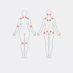 Fibromialgia como fadiga, músculo e estresse se integram