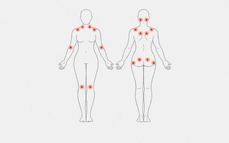 Fibromialgia como fadiga, músculo e estresse se integram